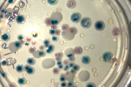 top down view of circular culture plate, with a variety of sizes of scattered blobs: black, white, brown, and clear