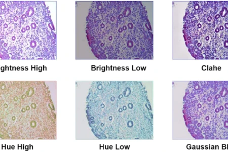 The model enhances the images in various ways to highlight the most important area and analyse tissue. 