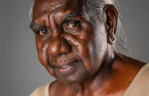 NI Honorary Dr Miriam-Rose Ungunmerr Baumann AM 