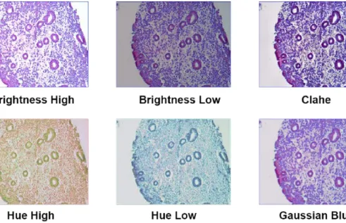The model enhances the images in various ways to highlight the most important area and analyse tissue. 